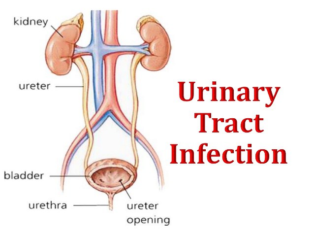 NUR226 Management of Catheter-Associated Urinary Tract Infection