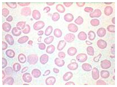 BMSC12003_Haematology_&_Transfusion Science