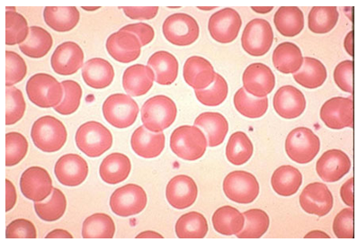 BMSC12003_Haematology_&_Transfusion_Science
