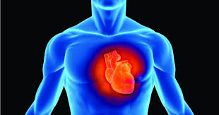 Acute Myocardial Infraction Assignment