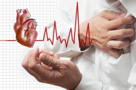 Acute Myocardial Infraction Assignment